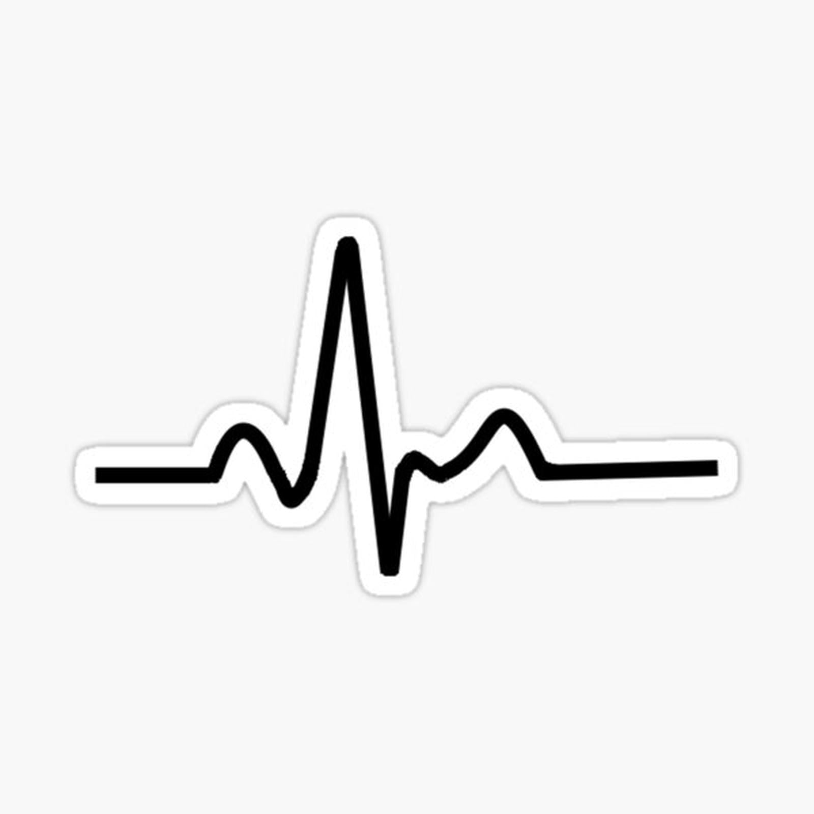 ECG Trace