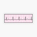 Hand Drawn Normal Electrocardiogram Pink