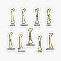 Hand Drawn Types of Fractures